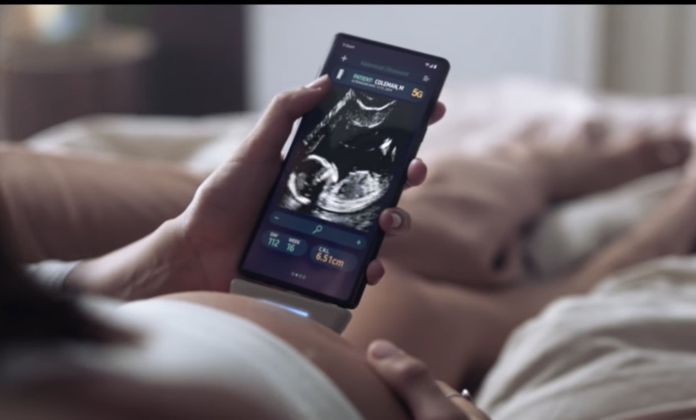 Samsung Ultrasound