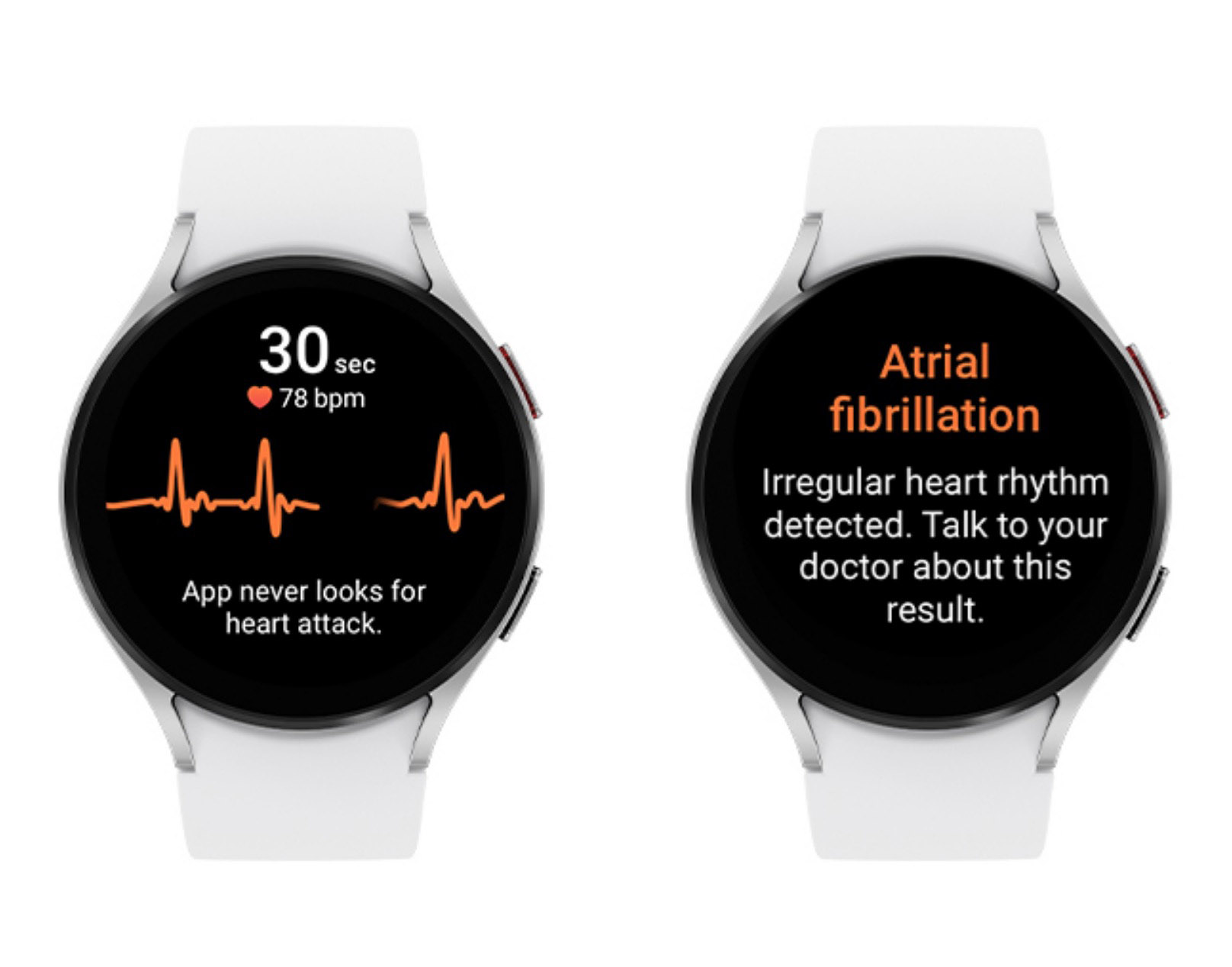 Galaxy Watch Irregular Heartbeat